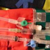 Angiografie